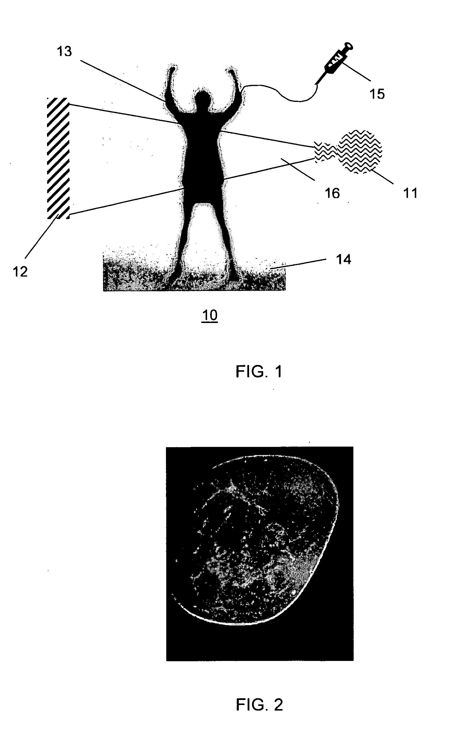 Contrast-enhanced cone beam X-ray imaging, evaluation, monitoring and treatment delivery