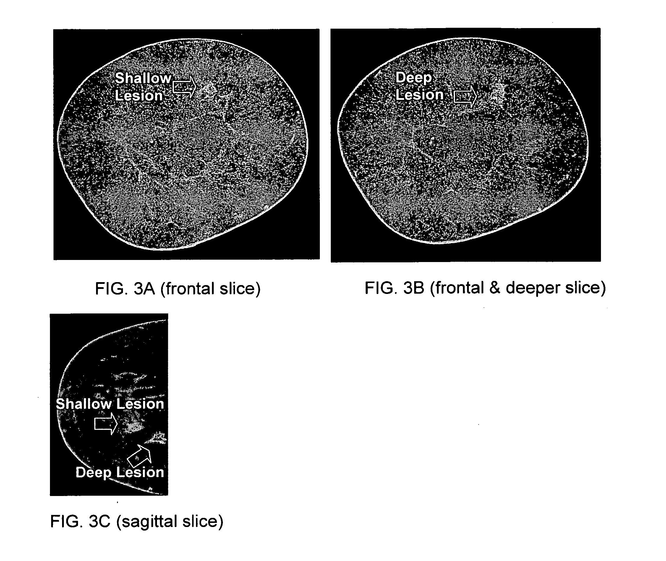 Contrast-enhanced cone beam X-ray imaging, evaluation, monitoring and treatment delivery