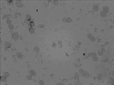 In-situ hybridization detection kit for MICRORNA (MICRO Ribonucleic Acid)-233 level at pathologic evolution early stage of colon cancer as well as microRNA-233 in-situ hybridization detection method and application of microRNA-233 to preparation of in-situ hybridization detection kit for colon cancer