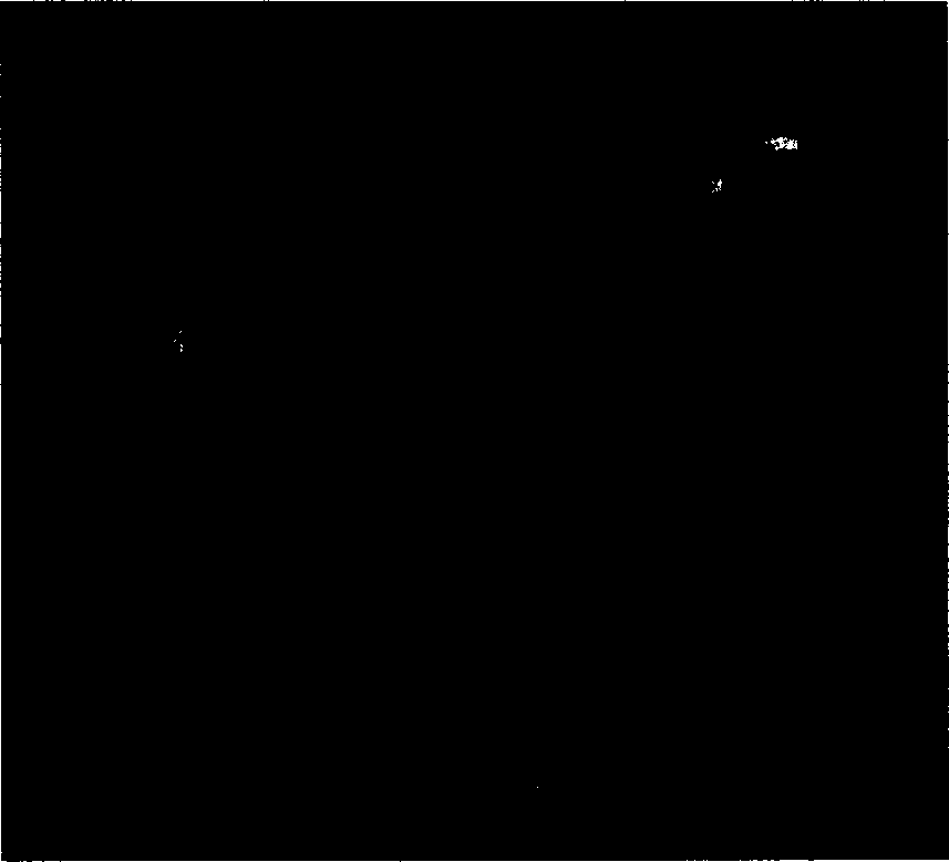 Use and medicine of 4-dedimethylamino tetracycline and its derivative in treating skin diseases