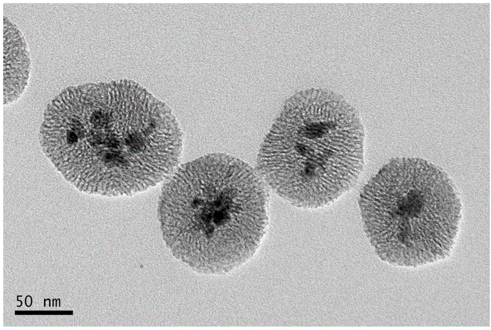 Chitosan-coated magnetic mesoporous silica core-shell structure nano-particle and preparation method and application thereof