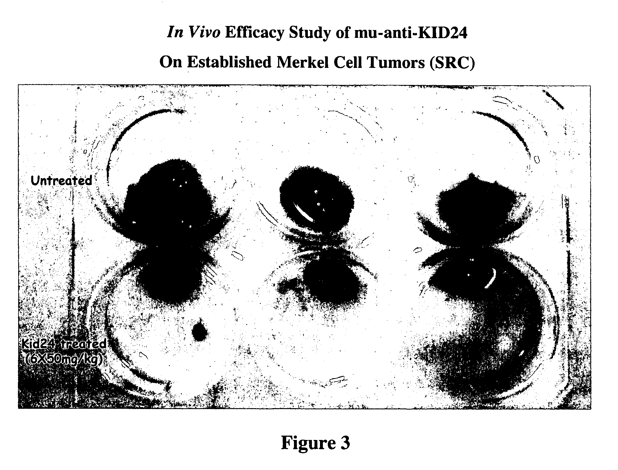 ADAM-9 modulators