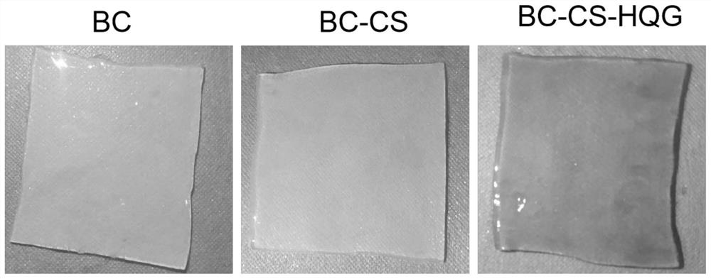 Double-network hydrogel wound dressing and preparation method thereof