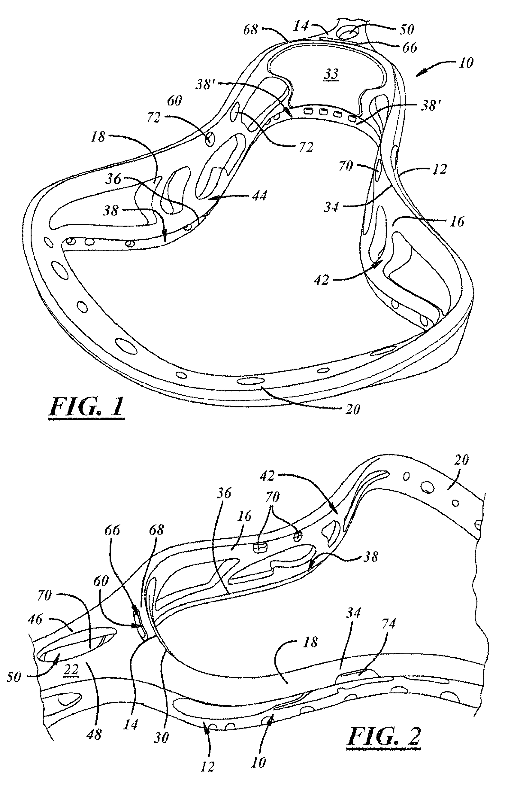 Lacrosse head with increased strength and playability characteristics