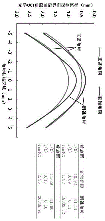 Keratectasia measurement method based on optical CT