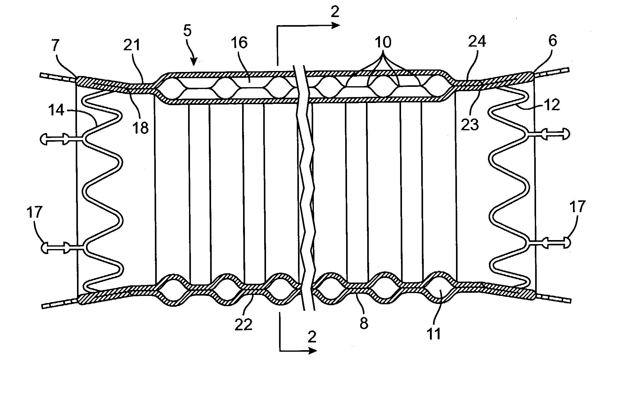 Kink resistant endovascular graft