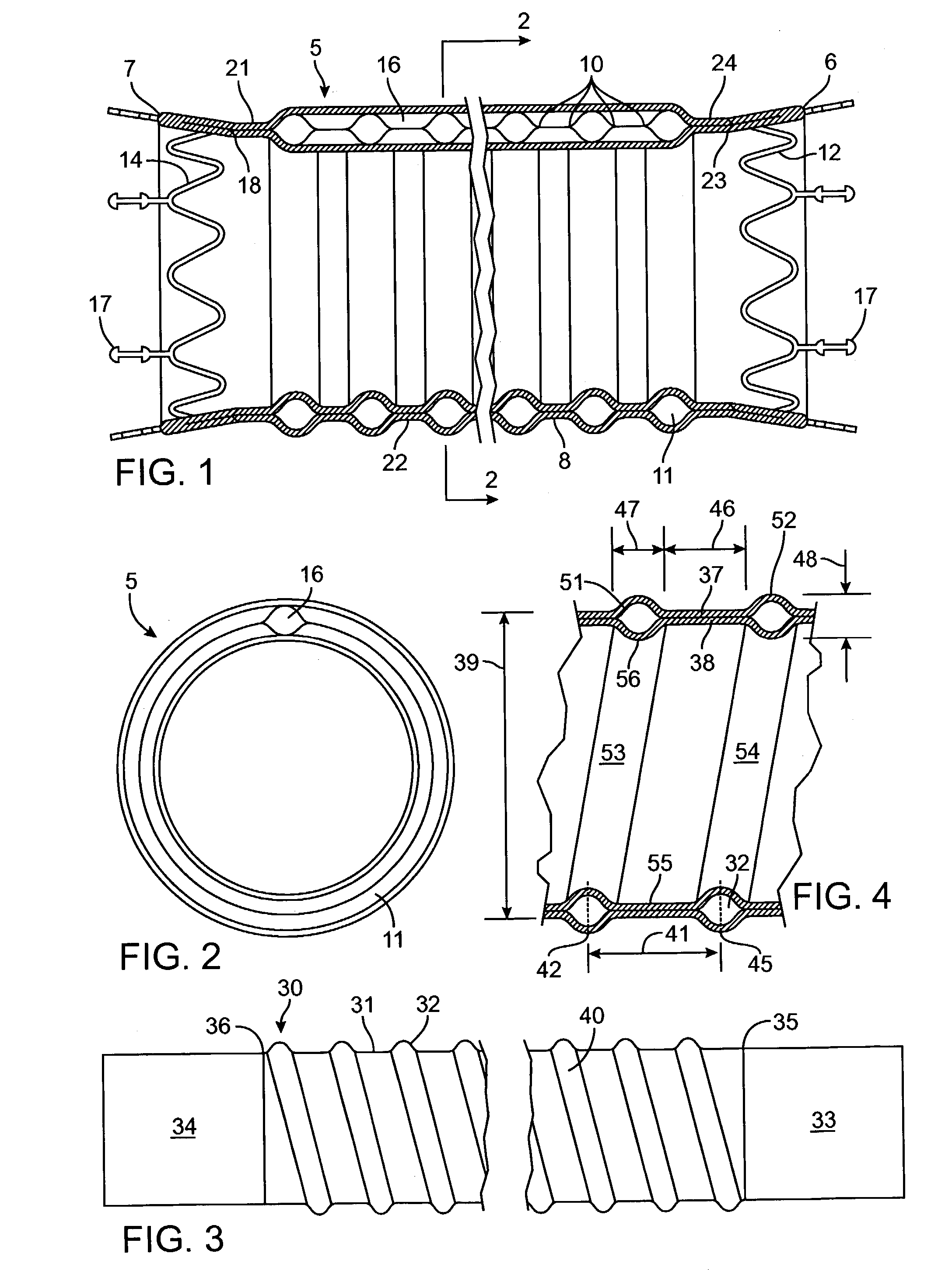 Kink resistant endovascular graft