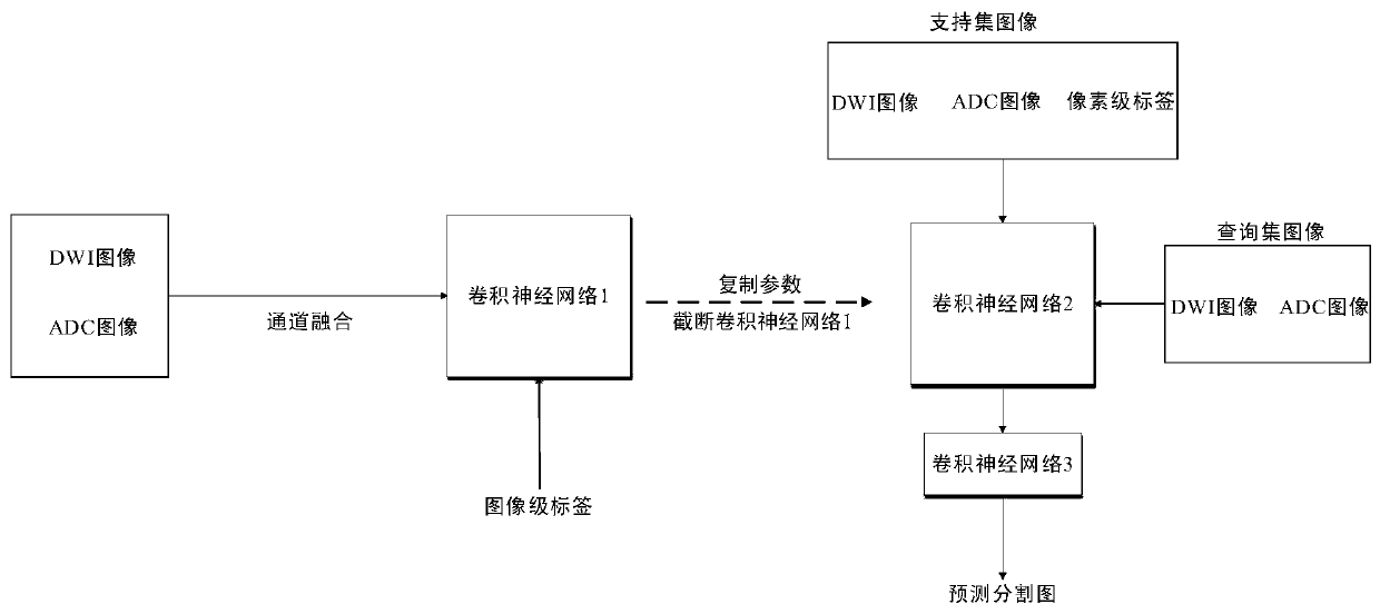 Acute cerebral apoplexy lesion segmentation method based on small sample learning