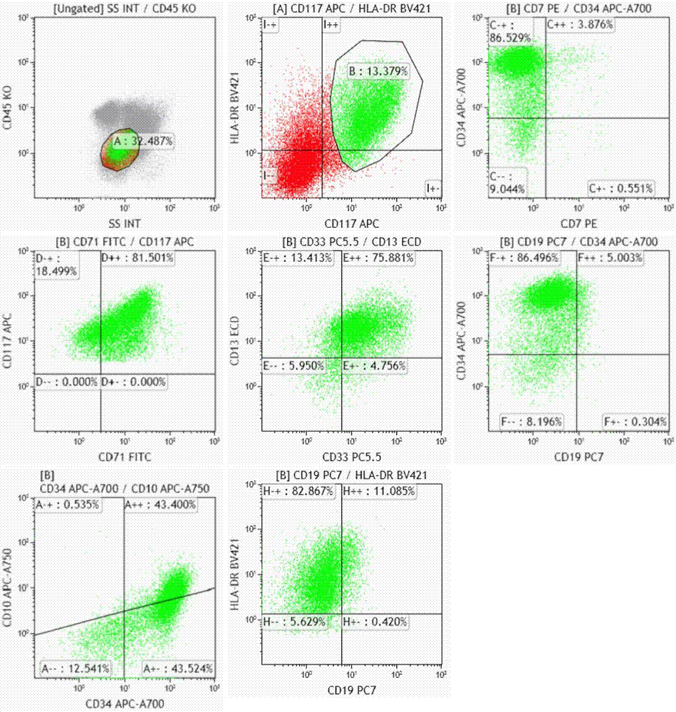 Shise antibody composition and its application in leukemia and lymphoma typing