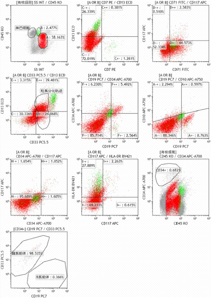 Shise antibody composition and its application in leukemia and lymphoma typing