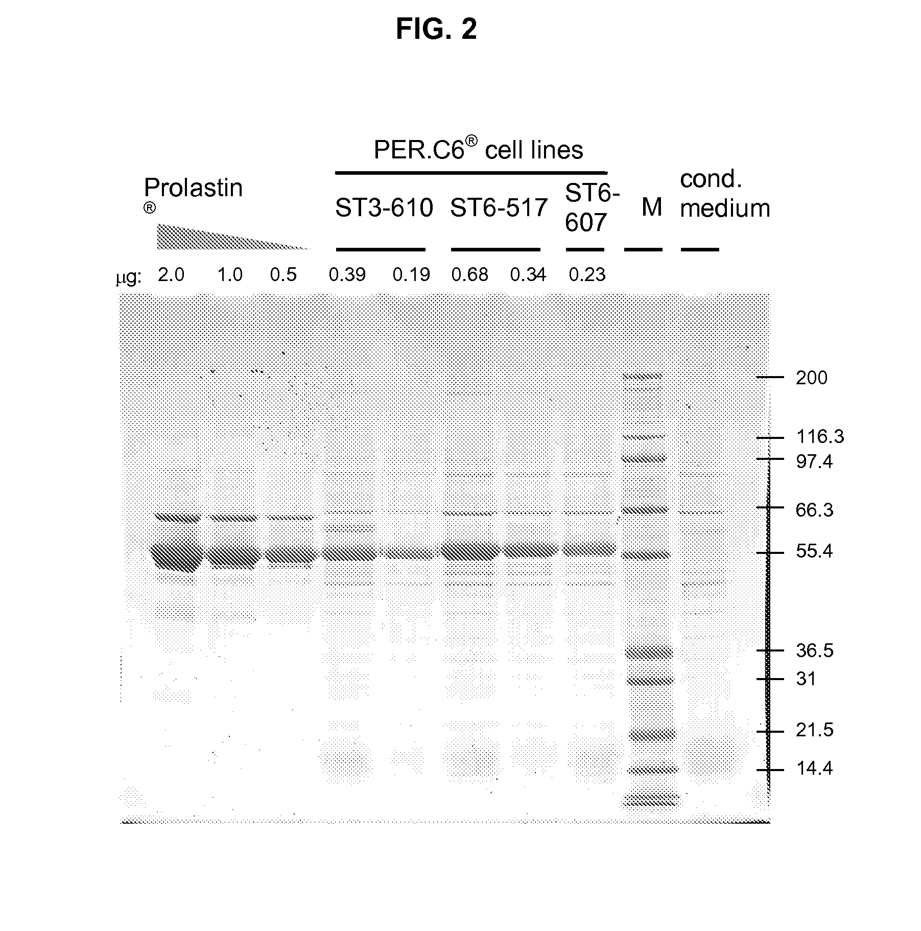 Recombinant human alpha1- antitrypsin