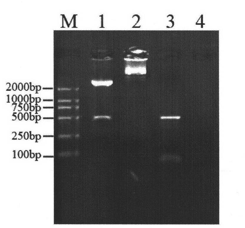 Rice XIOsPR10 gene and use thereof