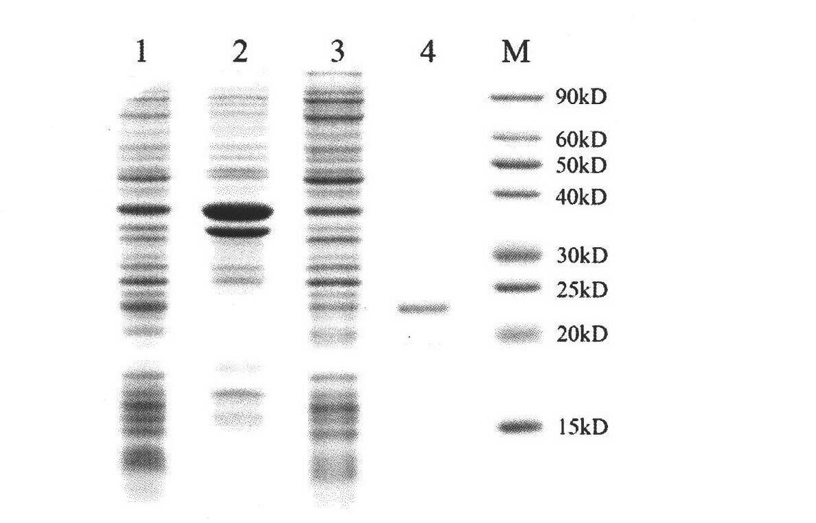 Rice XIOsPR10 gene and use thereof