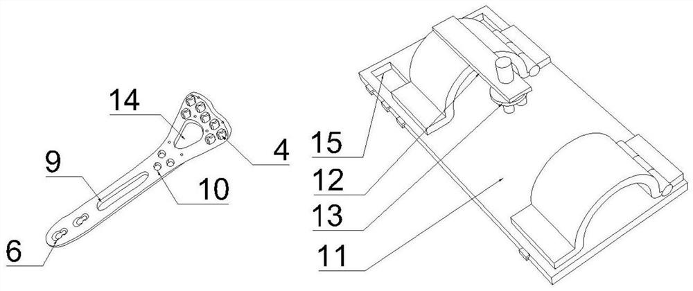 Distal radius bone setting steel plate capable of assisting in distraction reduction