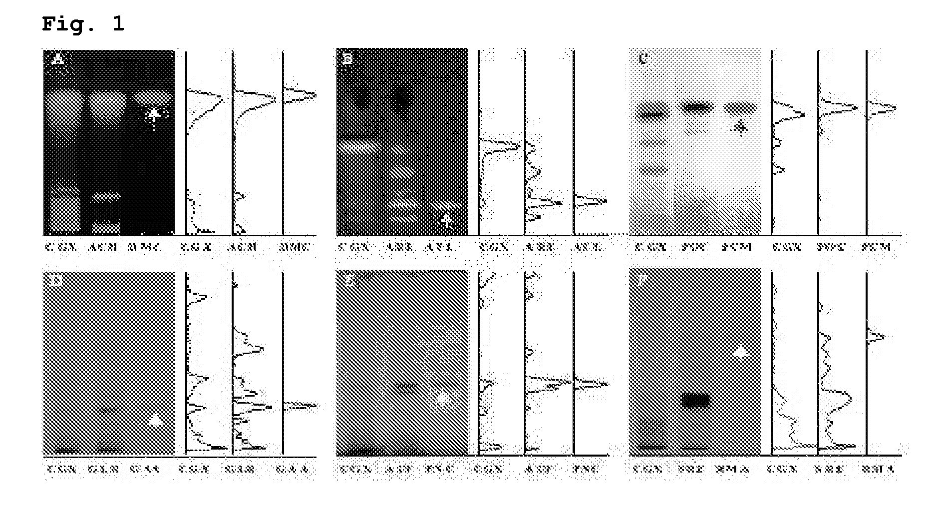 Compositions for protecting liver, or for preventing or treating liver fibrosis or cirrhosis