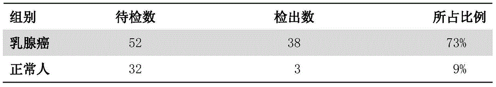 Application of prothymosin alpha to preparation of breast cancer diagnosis marker