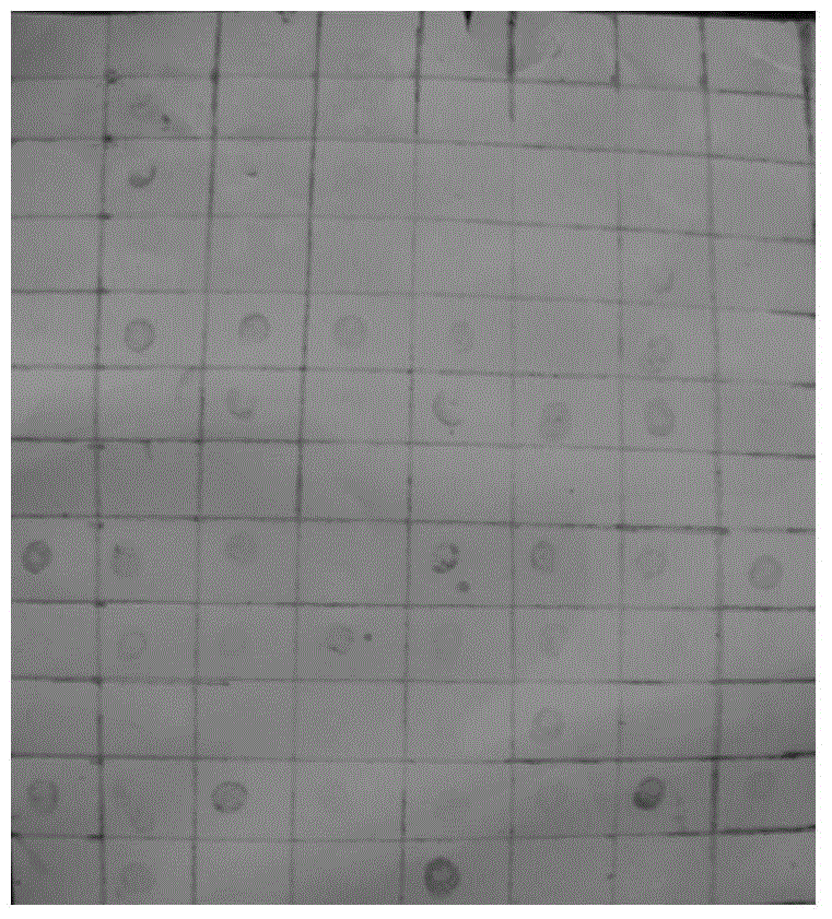 Application of prothymosin alpha to preparation of breast cancer diagnosis marker