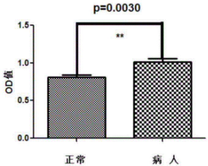 Application of prothymosin alpha to preparation of breast cancer diagnosis marker