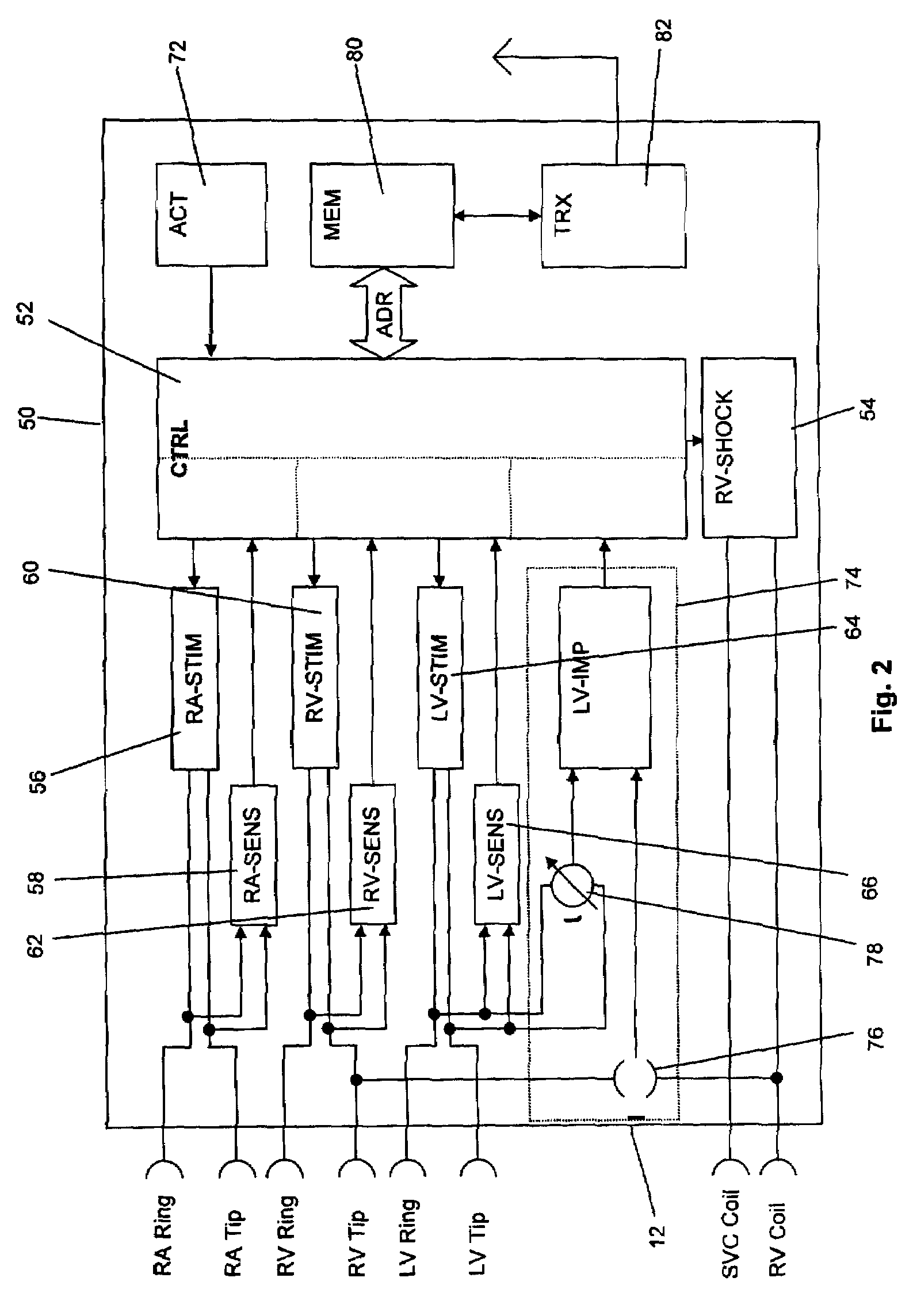 Implantable medical device and method for LV coronary sinus lead implant site optimization