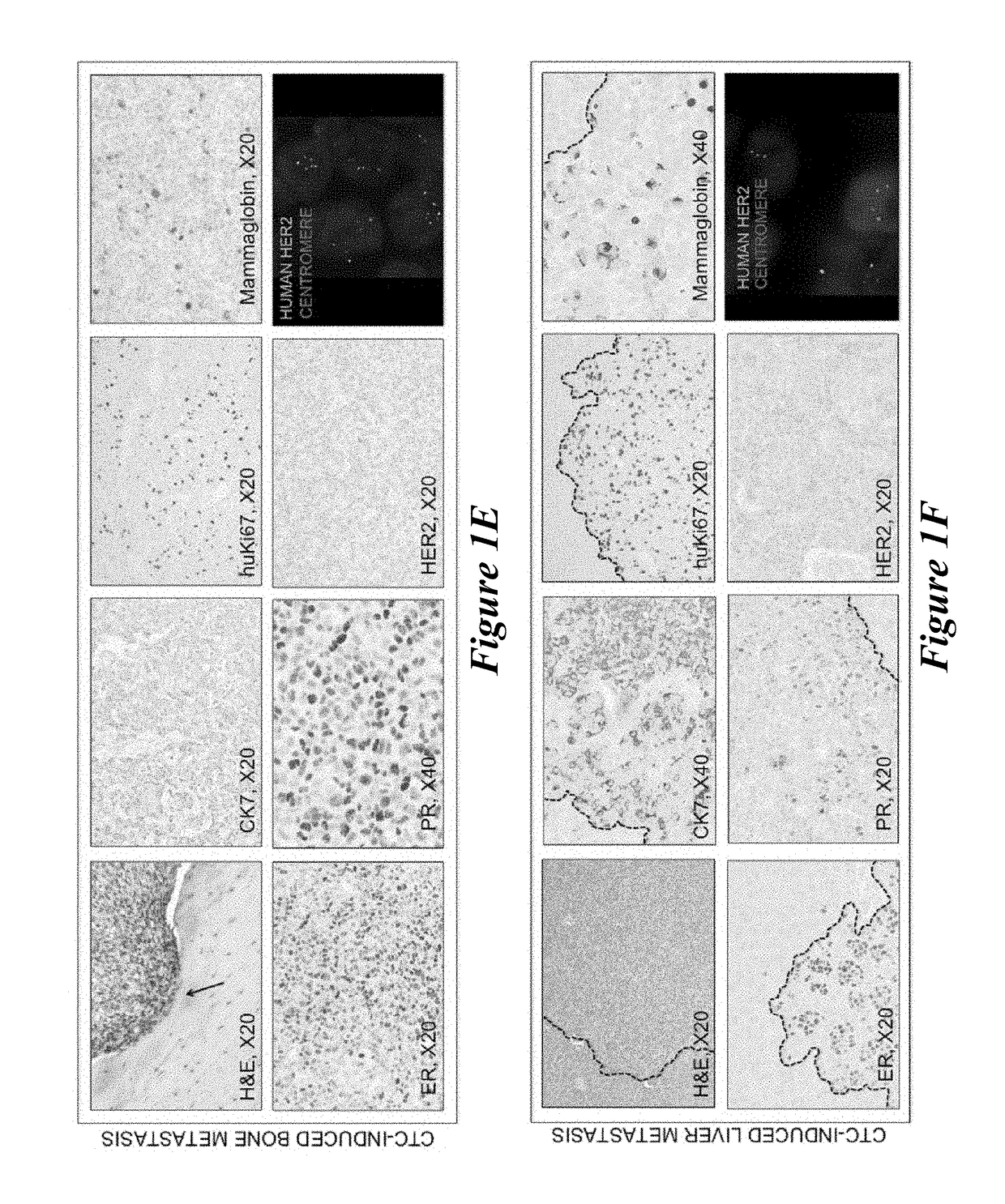 Novel method for analyzing circulating tumor cells of a patient for the presence of metastasis-initiating cells