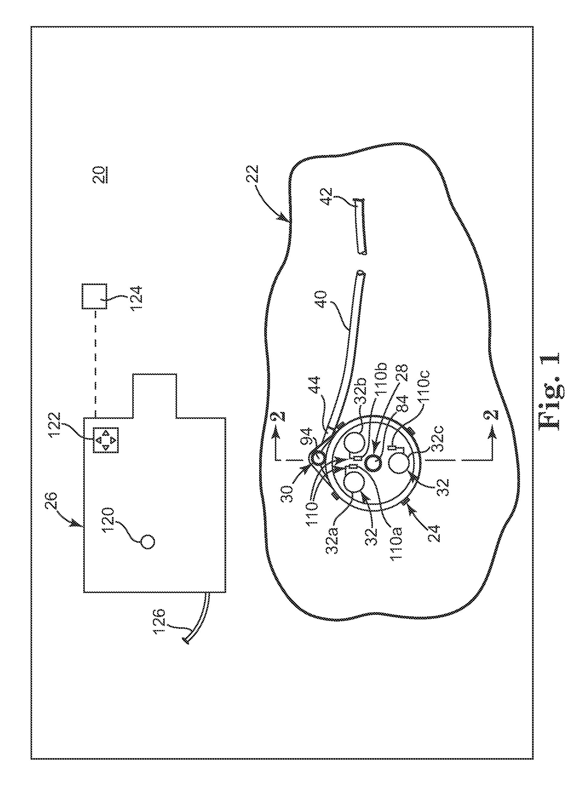 Septum port locator system and method for an implantable therapeutic substance delivery device