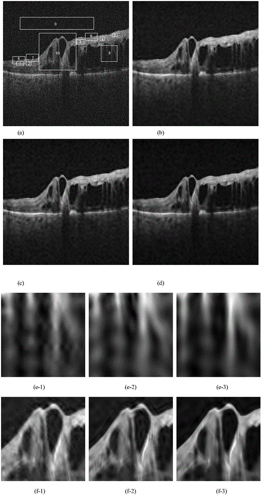 Speckle noise filtering method for optical coherence sectional image