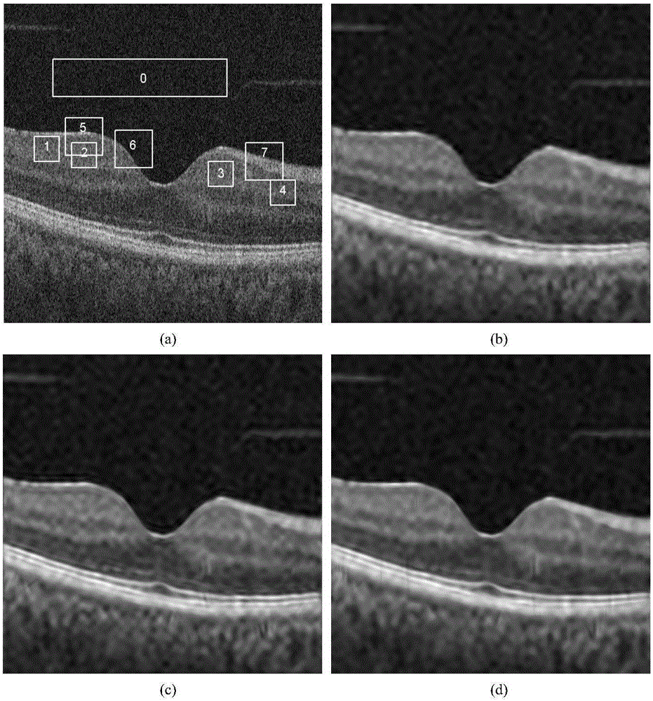 Speckle noise filtering method for optical coherence sectional image