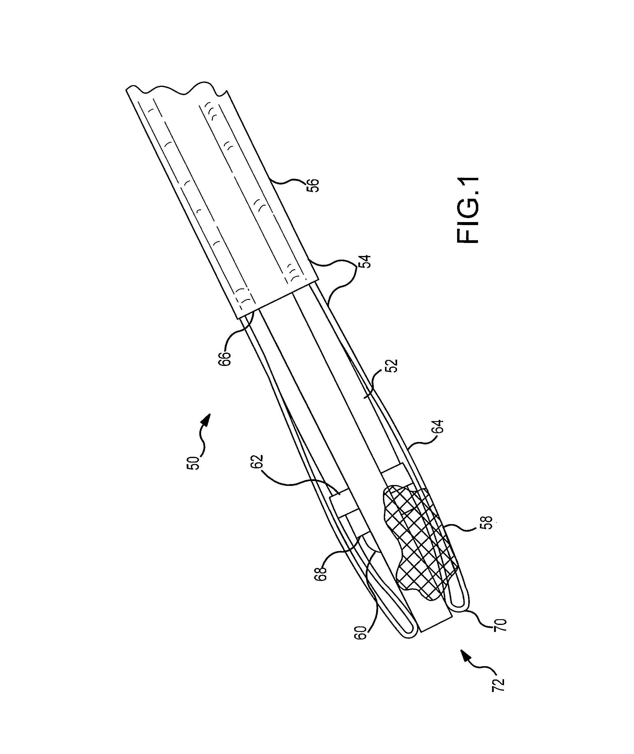 Endoscopic system for accessing constrained surgical spaces