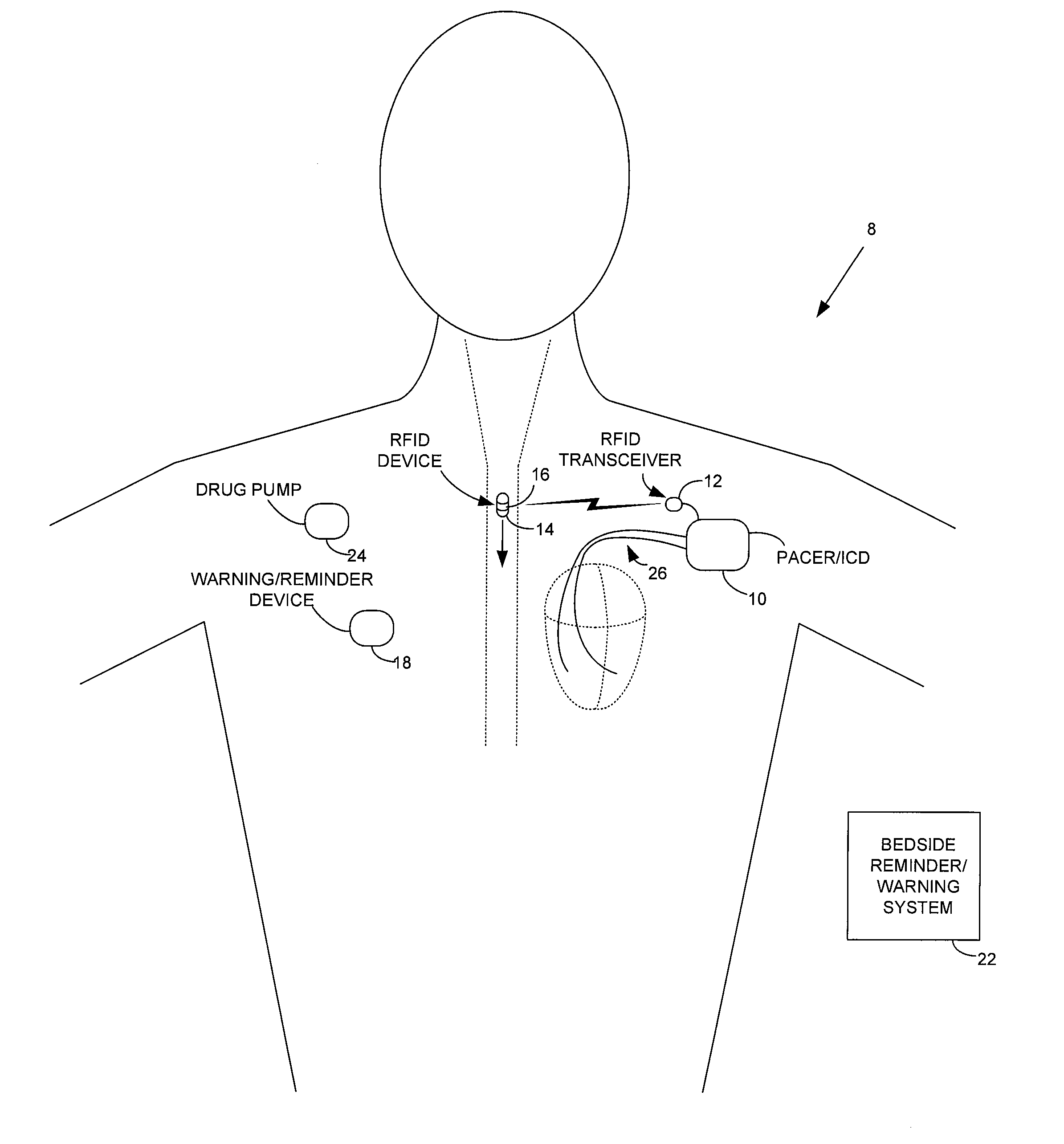 Method and apparatus for monitoring ingestion of medications using an implantable medical device