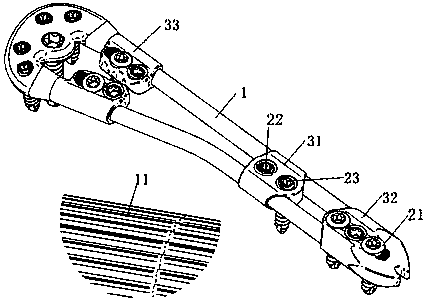 Locking power type bracket inner fixing device