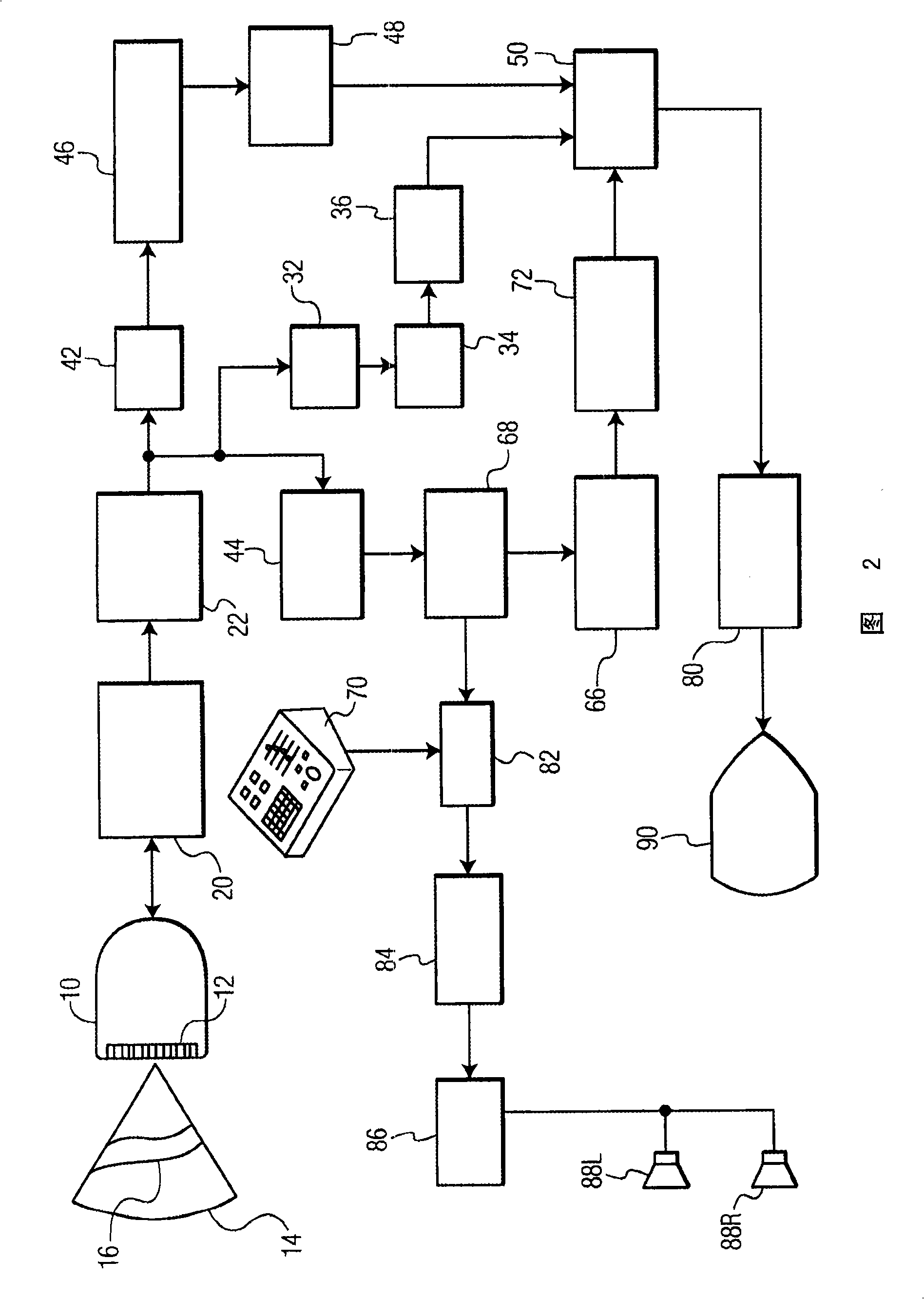 Ultrasonic diagnostic imaging system with spectral and audio tissue doppler