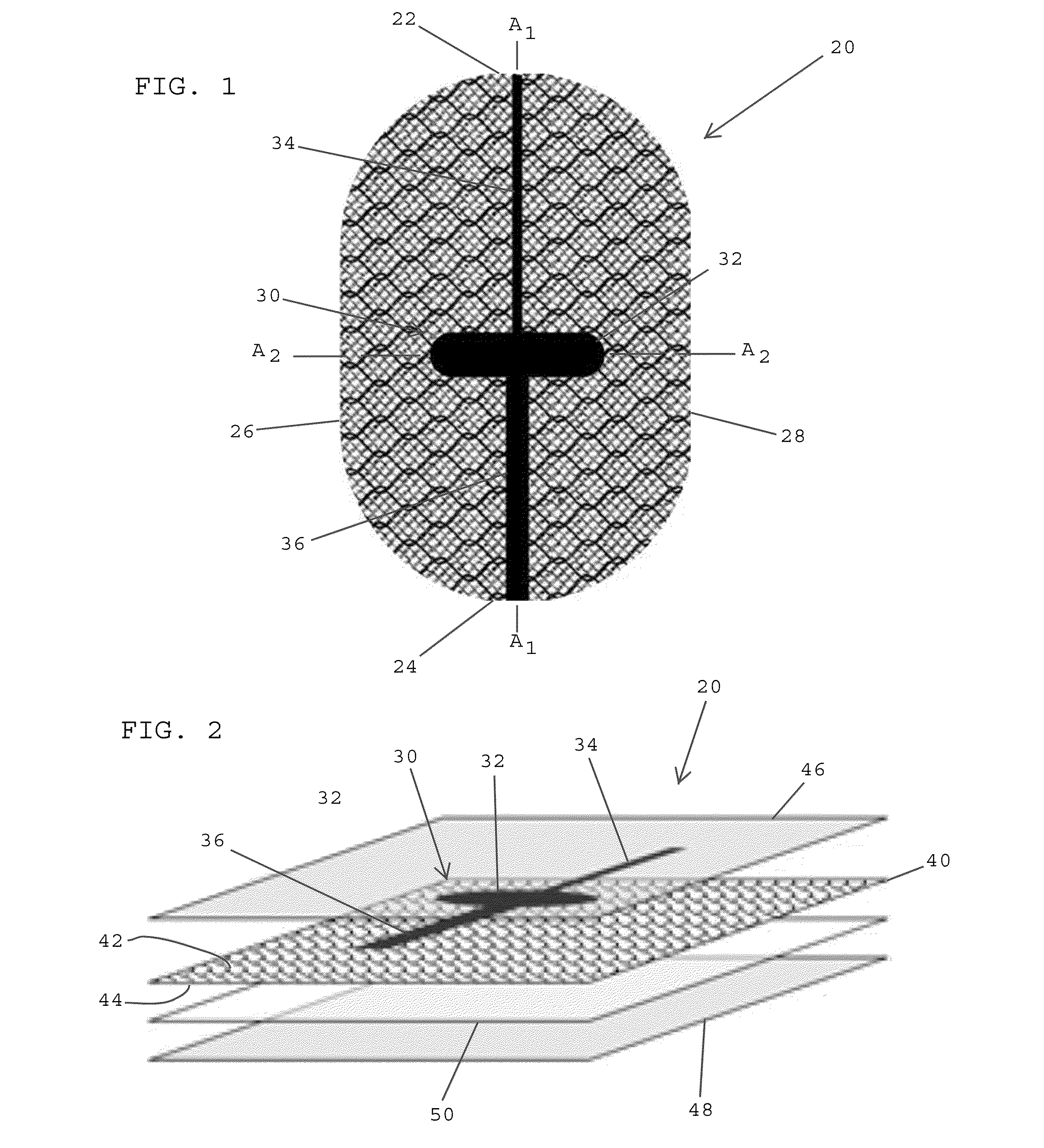 Composite anisotropic tissue reinforcing implants having alignment markers and methods of manufacturing same