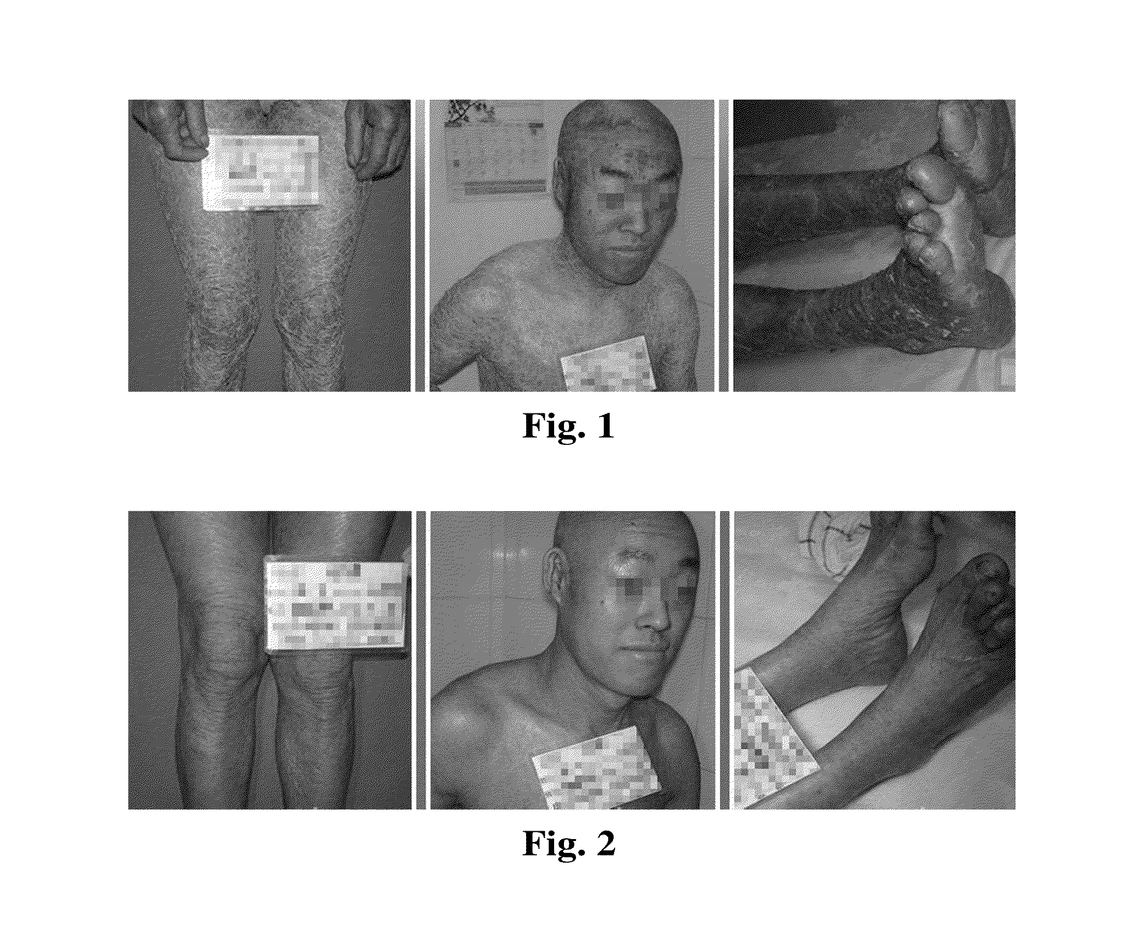 External-use traditional chinese medicine for ichthyosis and xerodermia, and preparation method thereof