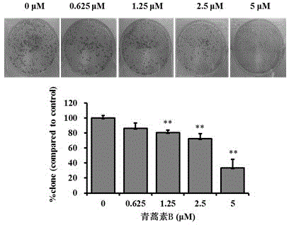 Effect of artemisinin B in A549 cell migration and invasion inhibition