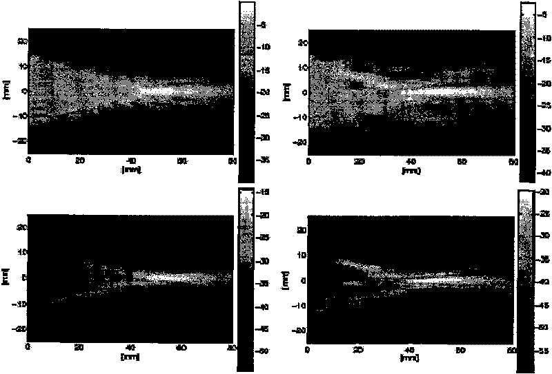 Inhibition method for complete type-B ultrasonic instrument supersonic wave aberration based on transmission iterative method