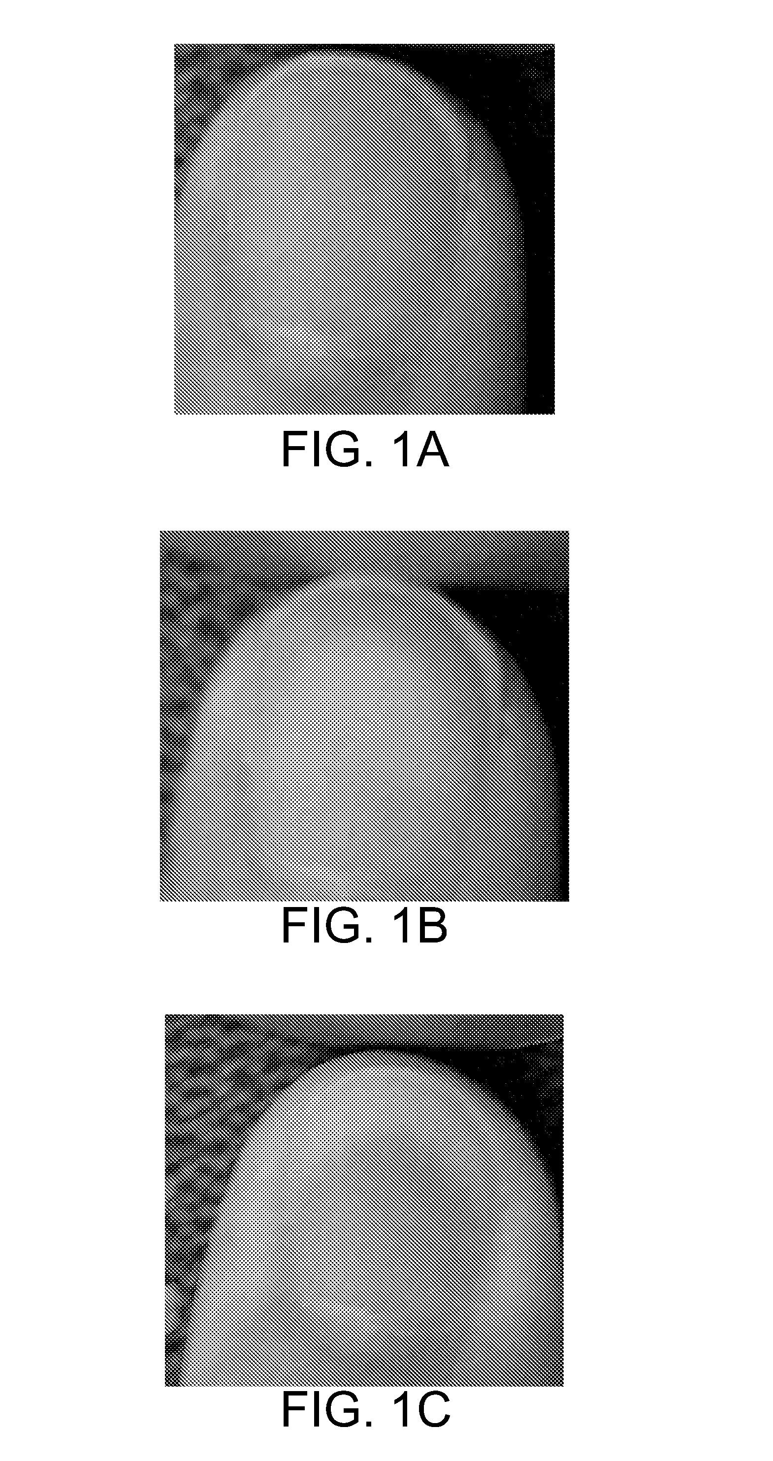 Optical systems for diagnosing and monitoring dermal microvascular health