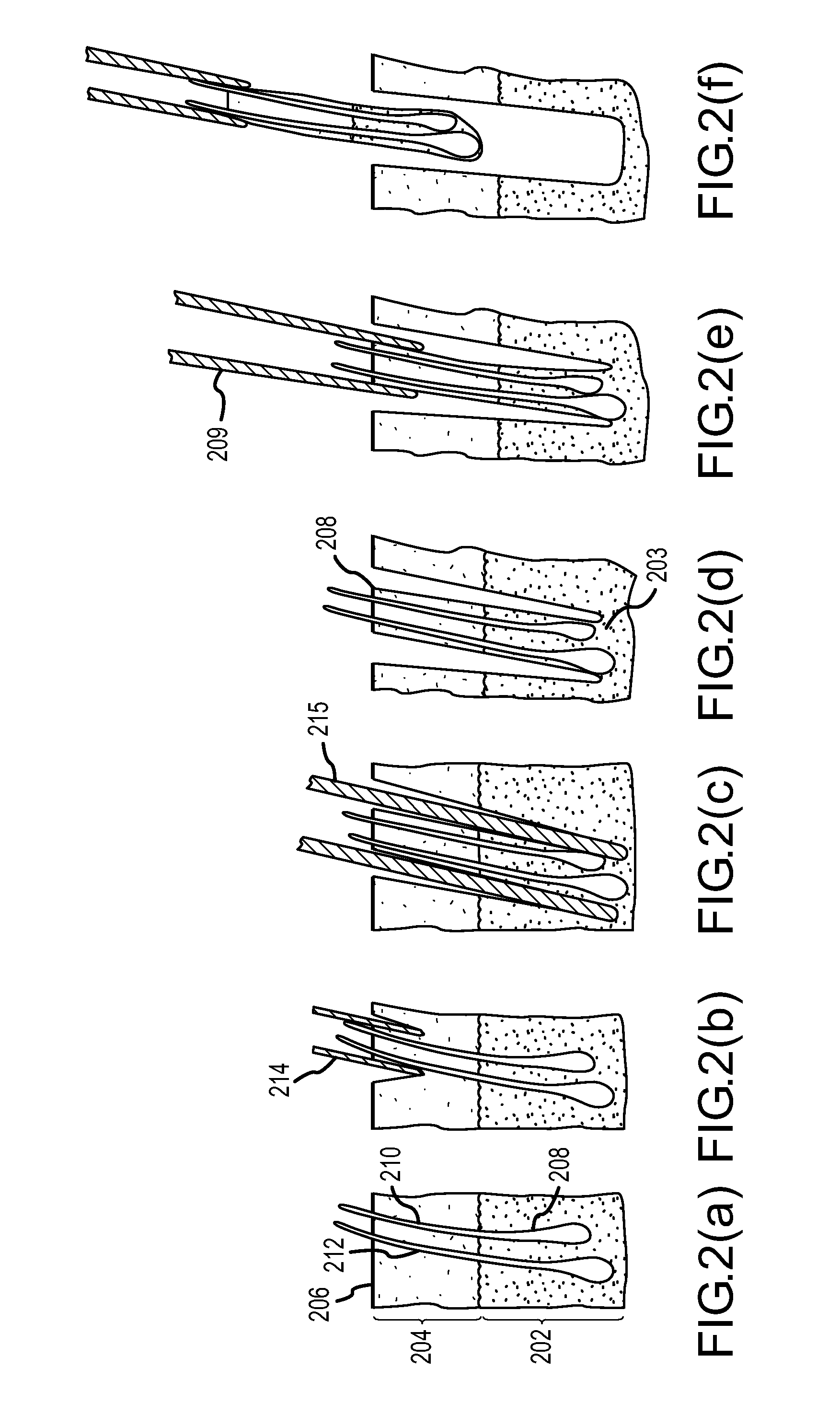 Follicular extraction method and device