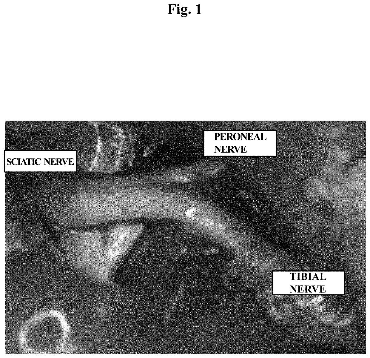 Nerve regeneration-inducing material