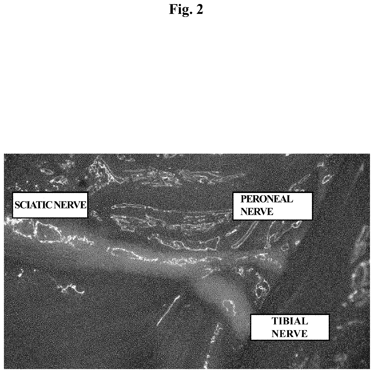 Nerve regeneration-inducing material