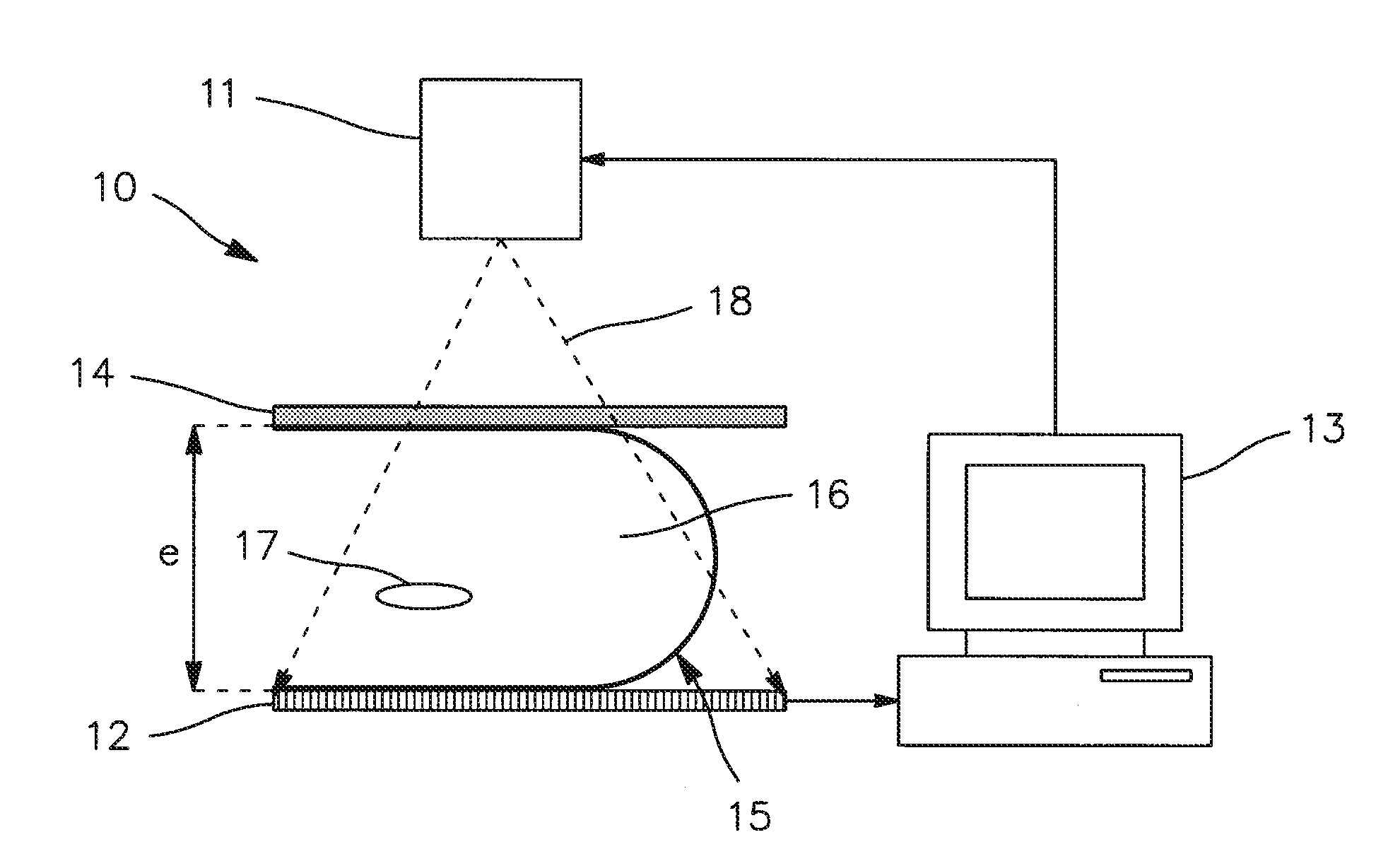 Method of processing radiological images, and, in particular, mammographic images