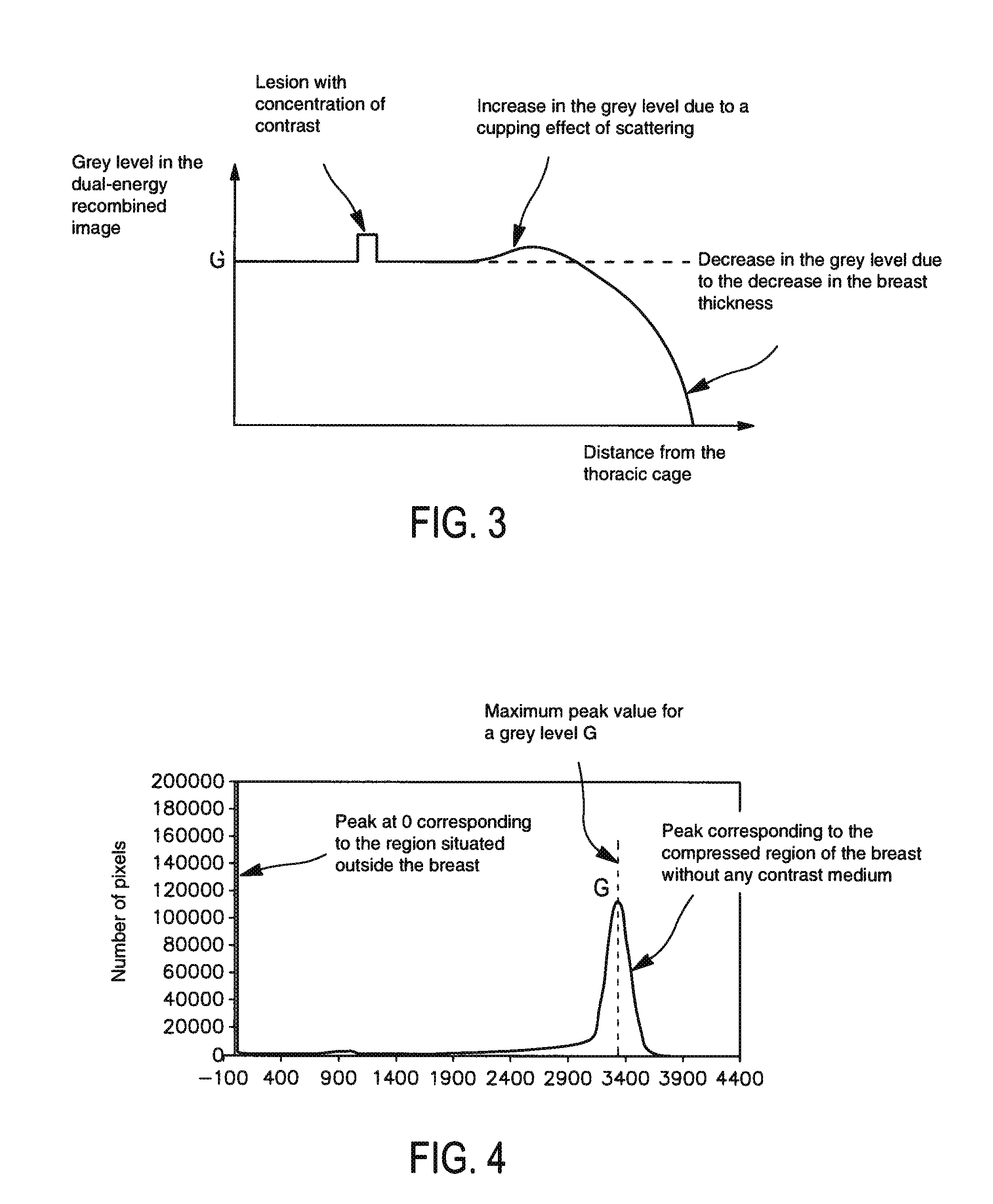 Method of processing radiological images, and, in particular, mammographic images