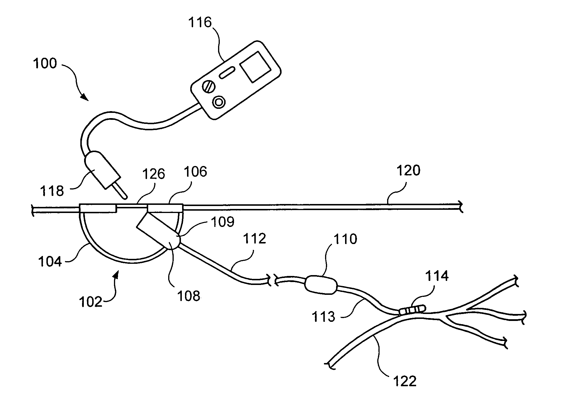 Percutaneous access for neuromodulation procedures