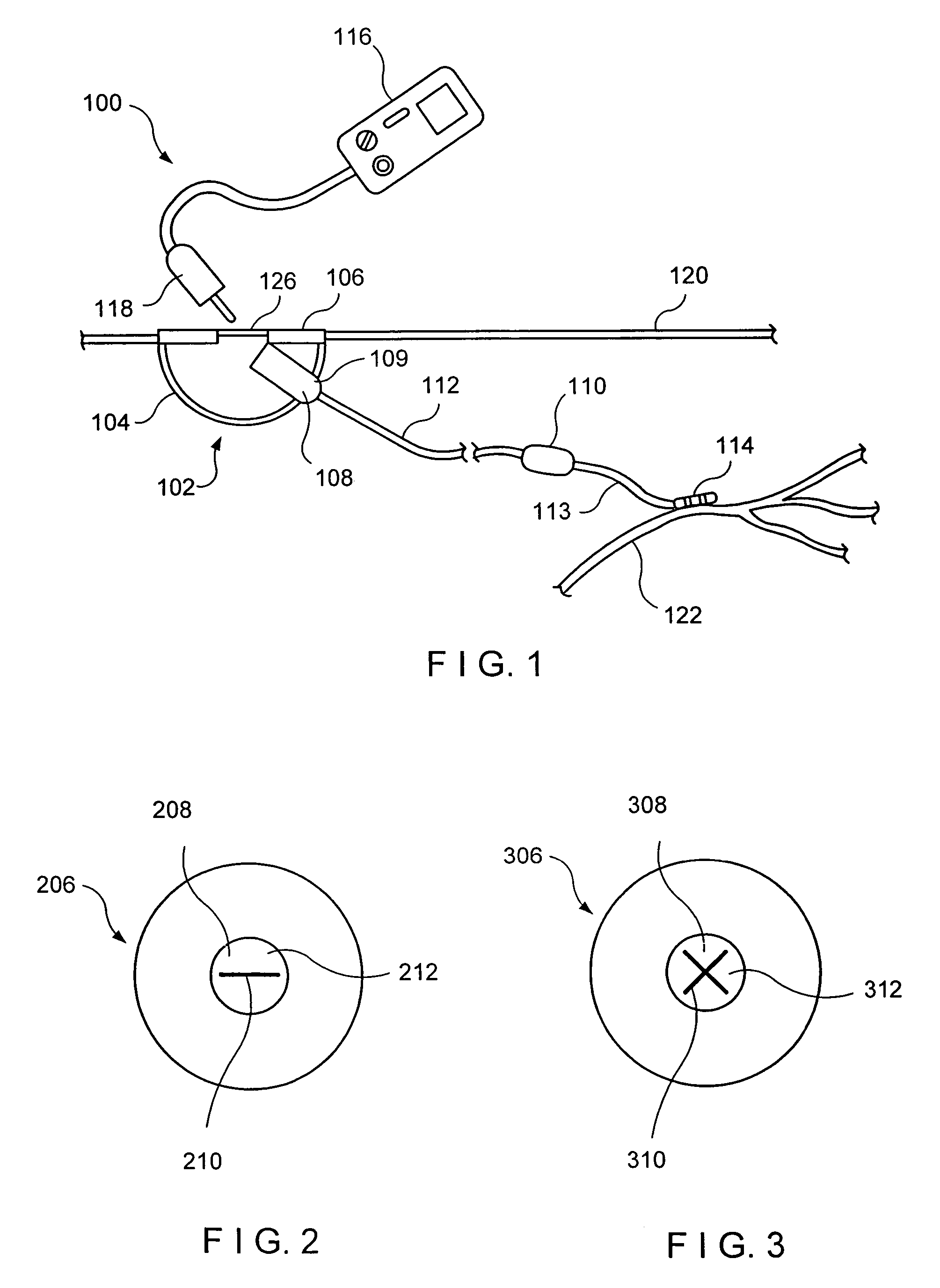 Percutaneous access for neuromodulation procedures