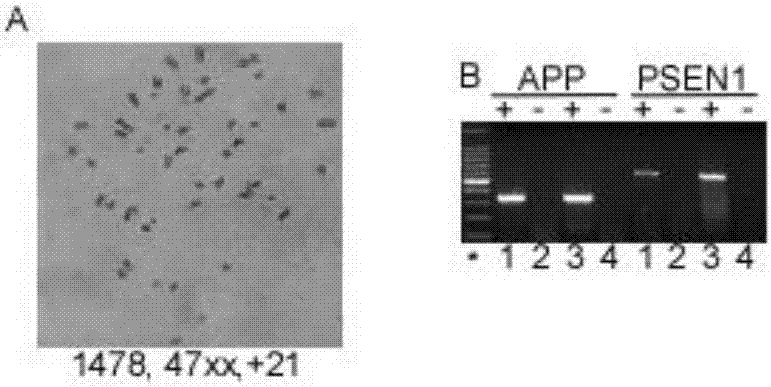 Application Let-7C gene to preparation of drug for treating Alzheimer disease