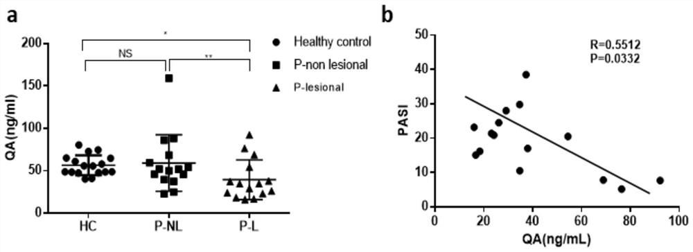 Method for inhibiting occurrence of psoriasis by adopting tryptophan metabolite