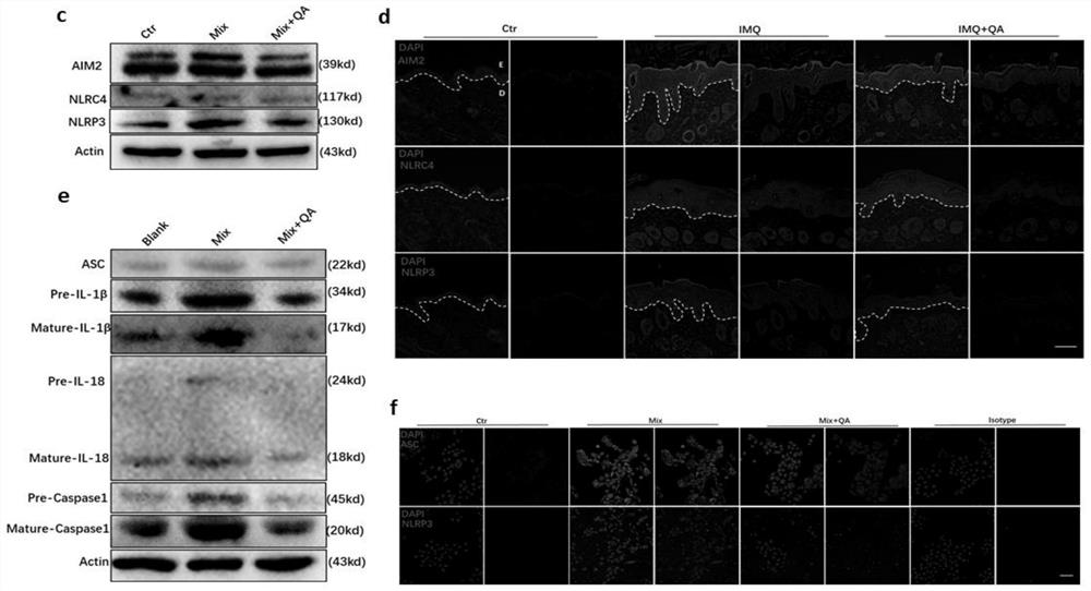 Method for inhibiting occurrence of psoriasis by adopting tryptophan metabolite