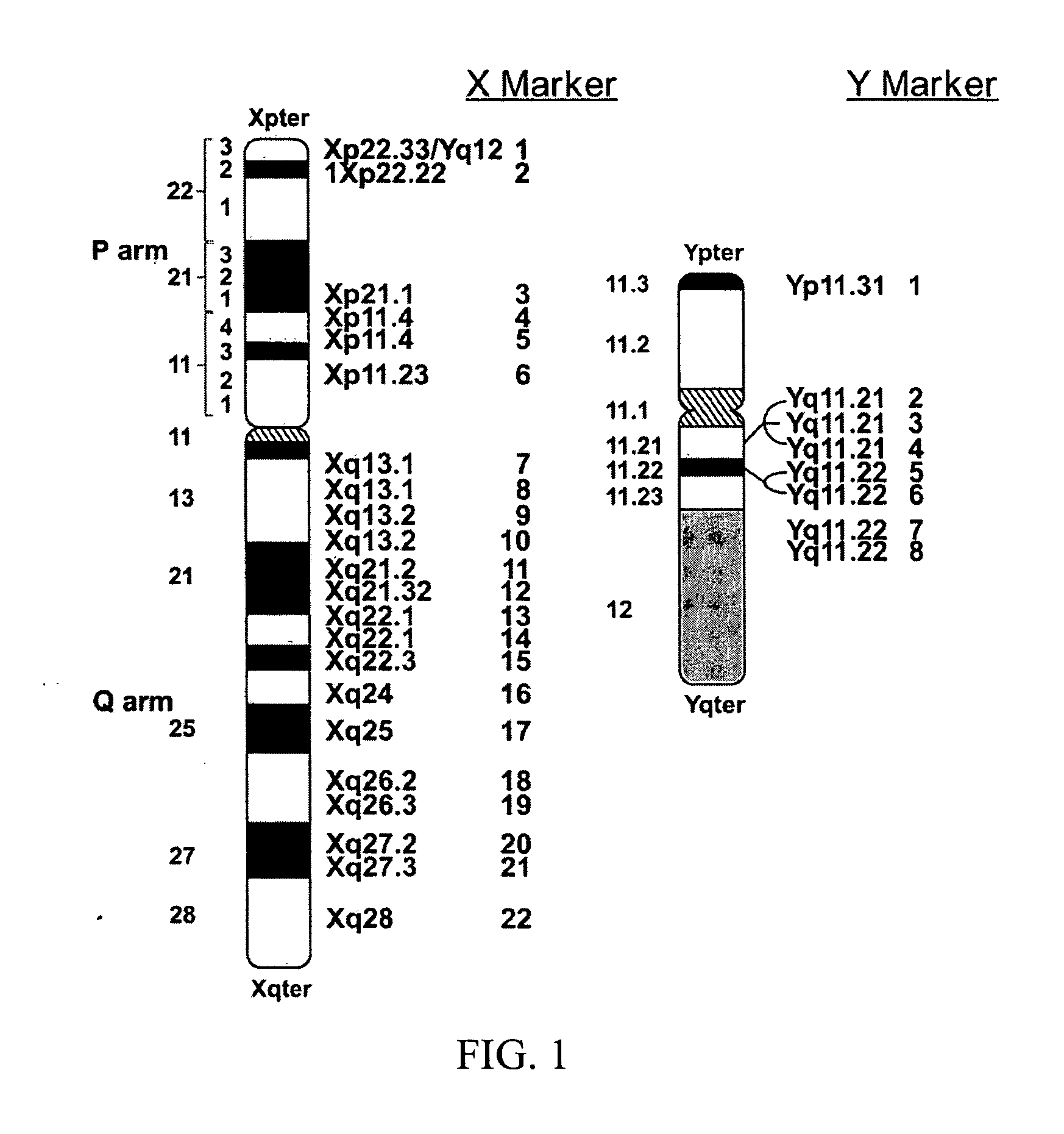 DNA diagnostic screening for turner syndrome and sex chromosome disorders