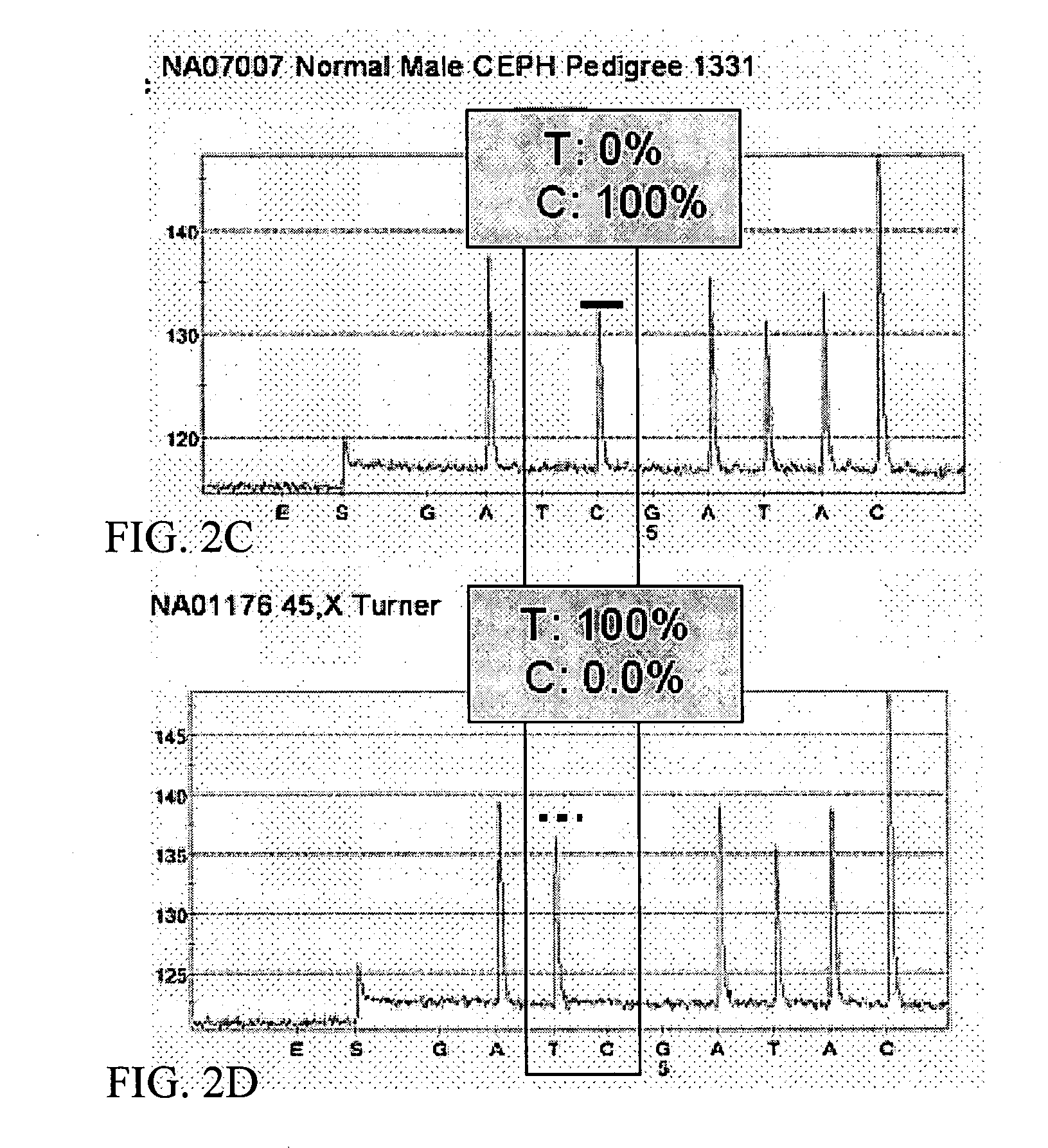 DNA diagnostic screening for turner syndrome and sex chromosome disorders