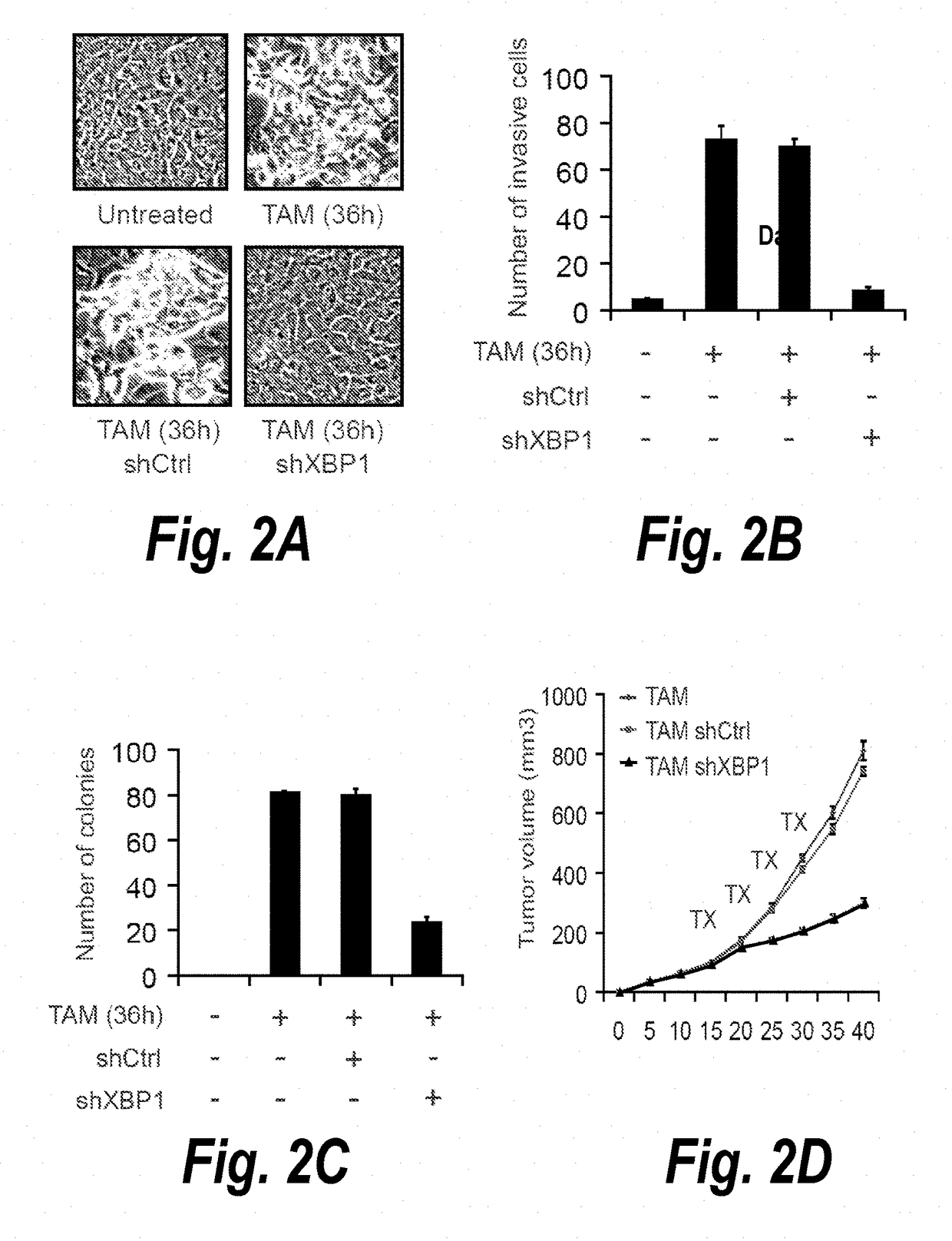 Modulation of breast cancer growth by modulation of xbp1 activity