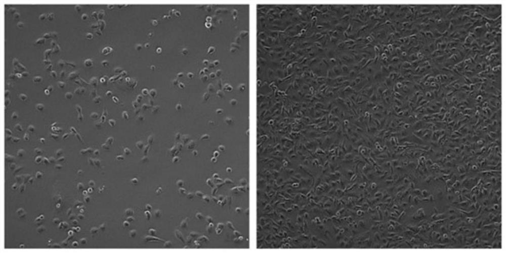 A Chinese lung adenocarcinoma cell line and its application